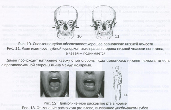 Правая сторона челюсти